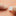 MicroMend Emergency Skin Closure_67693670301769-6